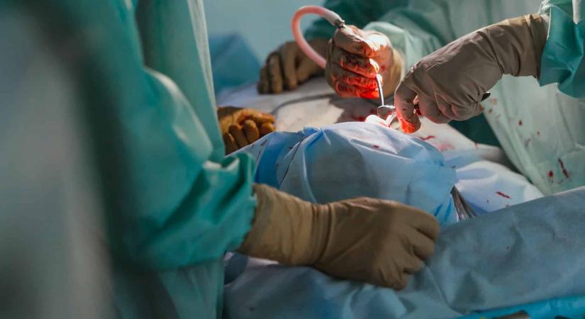 Kényszerítették a sebészt, hogy érzéstelenítés nélkül vágjon ki szerveket egy élő emberből