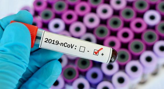 Száznál többen haltak meg koronavírusban a múlt héten Magyarországon