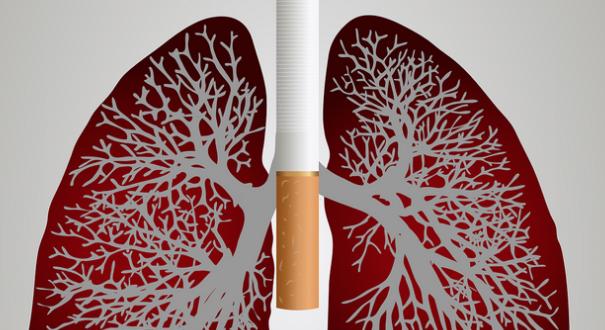 Előrelépés a tüdőrák, új eljárások az asztma és a COPD kezelésében
