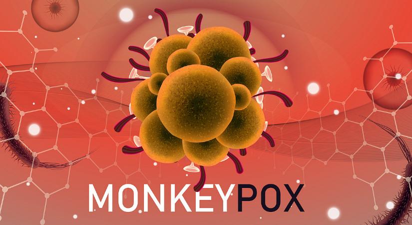 Új fertőzés terjed, már Bécsben van a majomhimlő