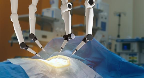 Sebészeti robot áll hamarosan szolgálatba a Pécsi Tudományegyetem Klinikai Központjában