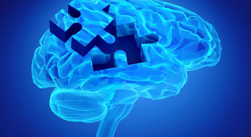 Ultraerős MRI-készülék segíthet a Parkinson-kór és a PSP jobb diagnózisában