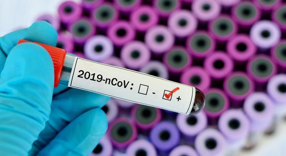 Az elmúlt héten 3080 új koronavírus-fertőzöttet találtak Magyarországon