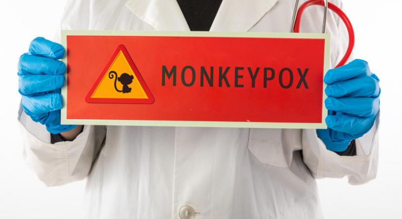 Itt a majomhimlő: minden, amit érdemes tudnod a betegségről