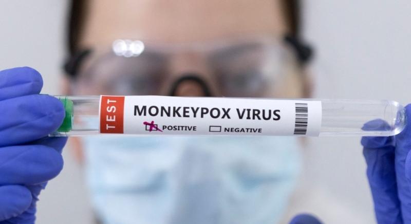 Évek óta jelen lehet Nagy-Britanniában a majomhimlő, vakcinákat tesztel a Moderna