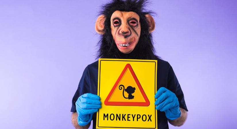 Mi az a majomhimlő? Mik a majomhimlő tünetei?