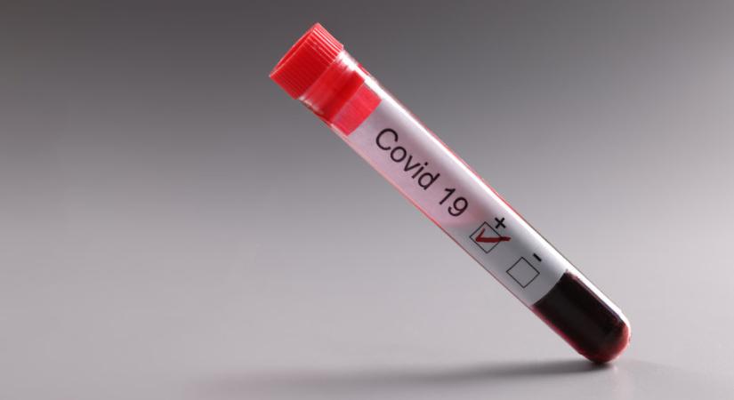 Egy nemi hormon oldhatja meg a súlyos COVID fertőzést
