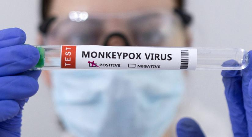 Újabb három majomhimlős beteget regisztráltak Magyarországon