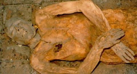 Egy múmiában találtak rá az ősi E. Coli baktériumra