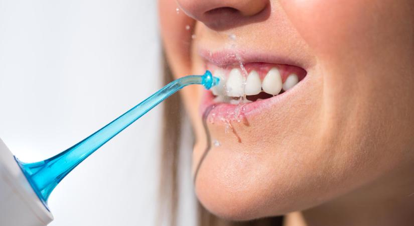 Hajlamosak vagyunk a fogszuvasodásra?Íme, néhány kevésbé ismert tipp amegelőzésre!