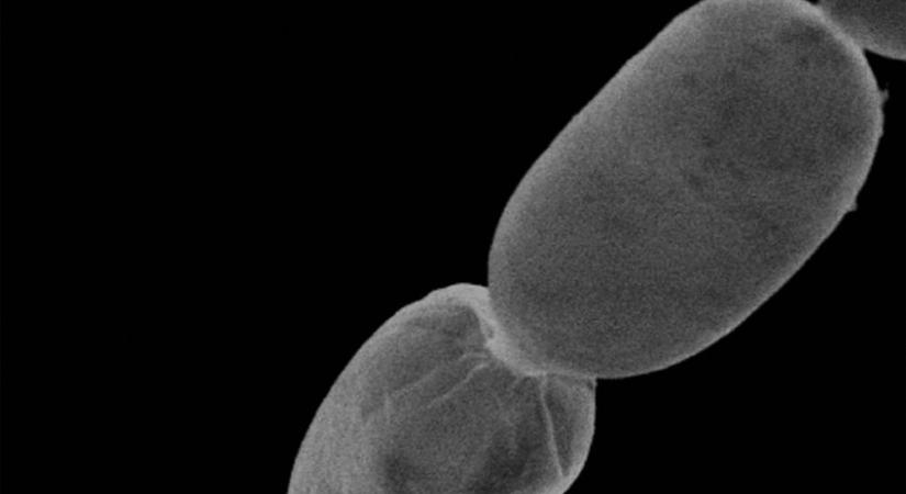A világ legnagyobb baktériumát fedezték fel