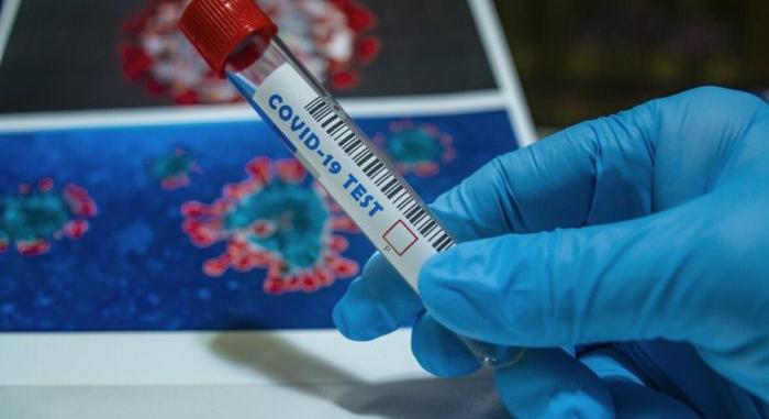 Koronavírus: Harmadik hete növekednek az esetszámok Csehországban