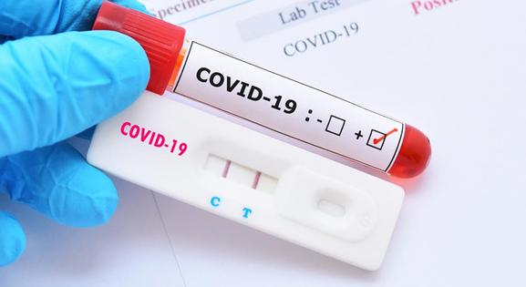 Koronavírus: megérkeztek a múlt heti adatok