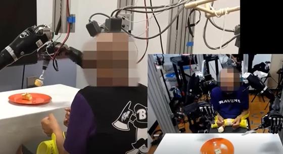 Elektródát ültettek az agyába, 30 év után tudott önállóan enni egy lebénult férfi – videó