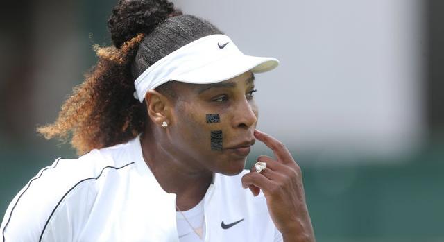 Serena Williams furcsa, fekete tapaszokkal az arcán teniszezik, kiderült miért