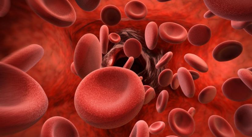 Leukémia is okozhat alacsony vérlemezkeszámot