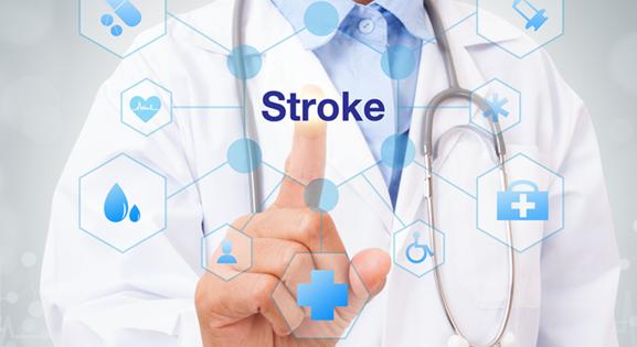 Új eljárás a magyarországi stroke-ellátásban