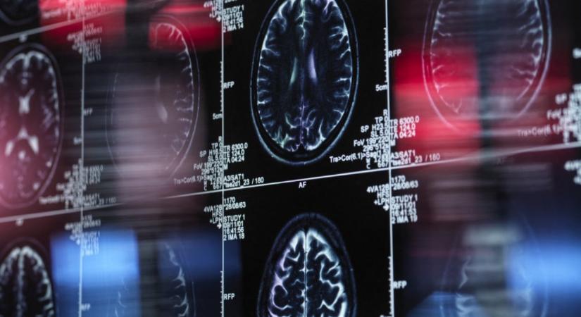 16 év Alzheimer-kutatása mehet a kukába?
