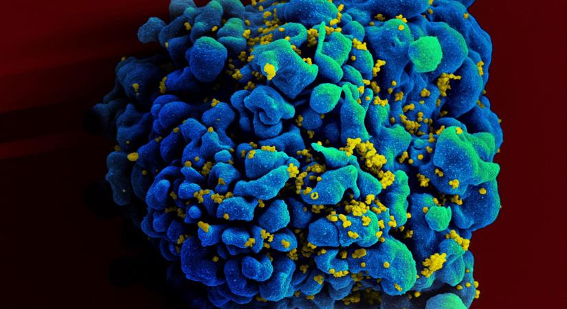 Vírusmentes az eddigi legidősebb HIV-páciens