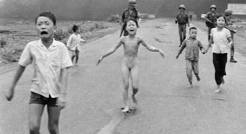 50 évvel a bombatámadás után kapta meg az utolsó kezelését a világhírű fotó megégett kislánya