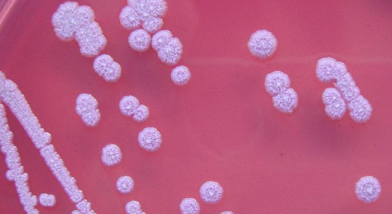 Csendesen fertőző, halálos baktériumot találtak
