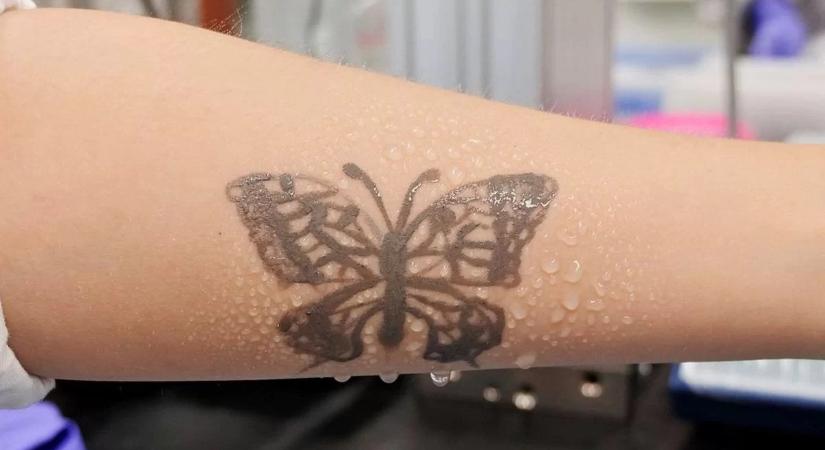 Nanotechnológiás tetoválás figyel az egészségedre