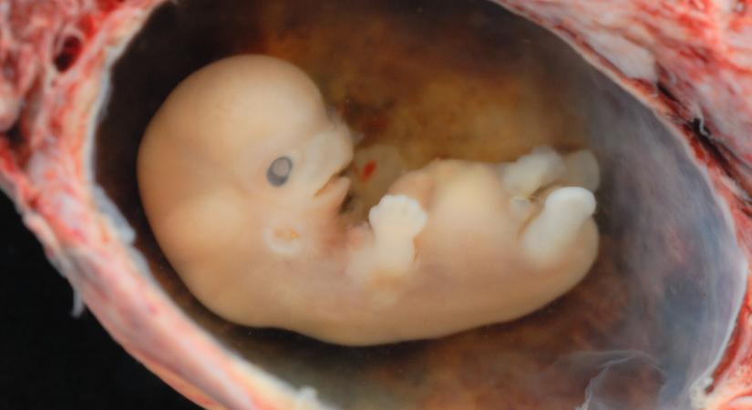 Először alkottak teljesen mesterséges embriót izraeli tudósok