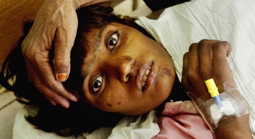 Kolerajárvány tört ki Afganisztánban