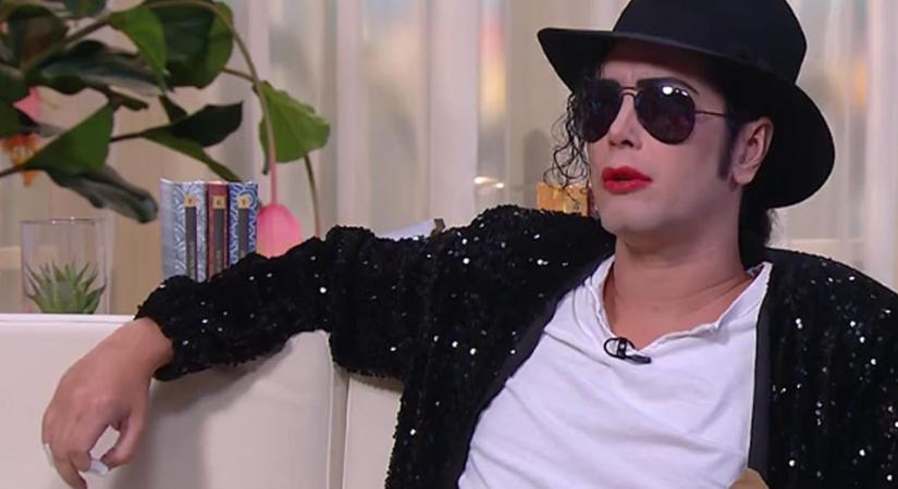 14 műtéten esett át Michael Jackson magyar hasonmása