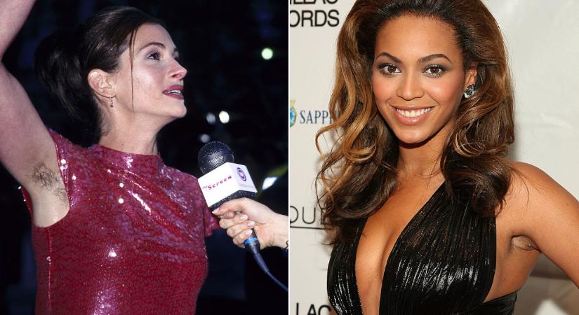 8 híres nő, aki néha felhagy a szőrtelenítéssel: azon sem akadnak ki, ha szőrös hónaljjal kapják őket lencsevégre