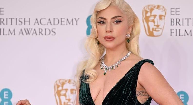 Lady Gaga szépségtitkai: ragyogó arcbőr 6 lépésben