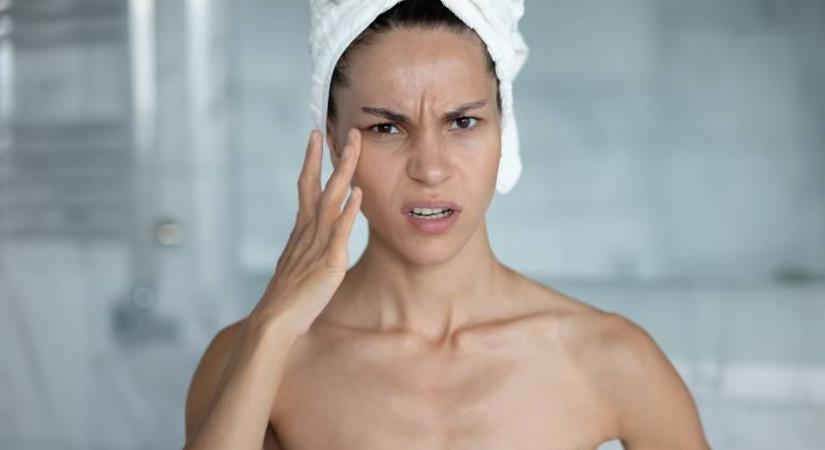 Ez a 6 legnagyobb hiba, amit elkövethetsz az arcbőröddel szemben