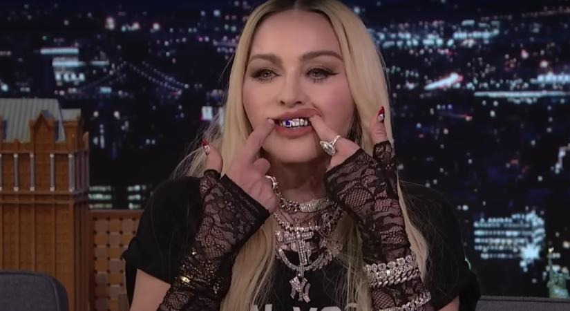 Madonna elmondta, miért hord rendszeresen fogékszert: Nagyon csúnya a fogsorom
