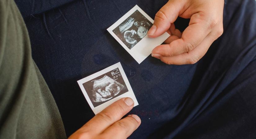 Miért nem fejlődik ki sok IVF embrió?￼