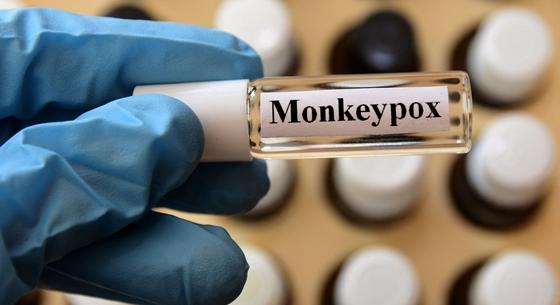 Tünetek nélkül is terjedhet a majomhimlő-vírus, több beteget is így diagnosztizáltak