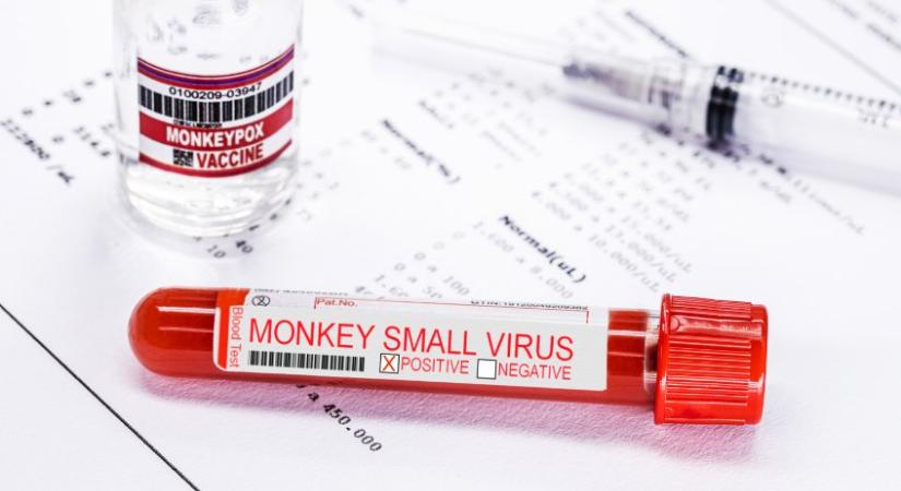 Hazánkban is olthatnak – Megérkezett a majomhimlő elleni védőoltás