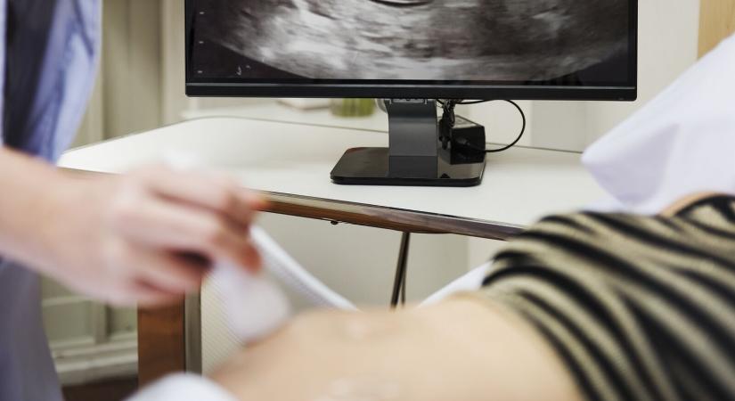 Az abortuszt mostantól a szívhang meghallgatásához kötik