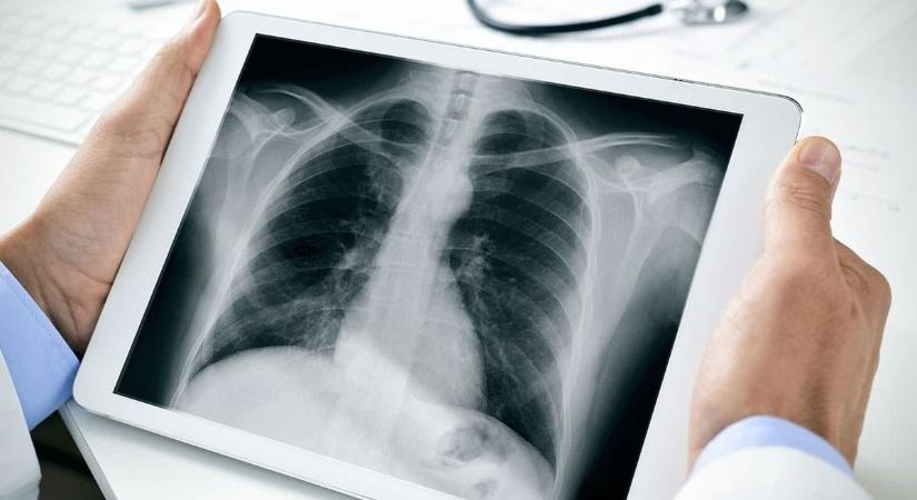Új készülék érkezik, szünetelnek a röntgenvizsgálatok Gyomaendrődön