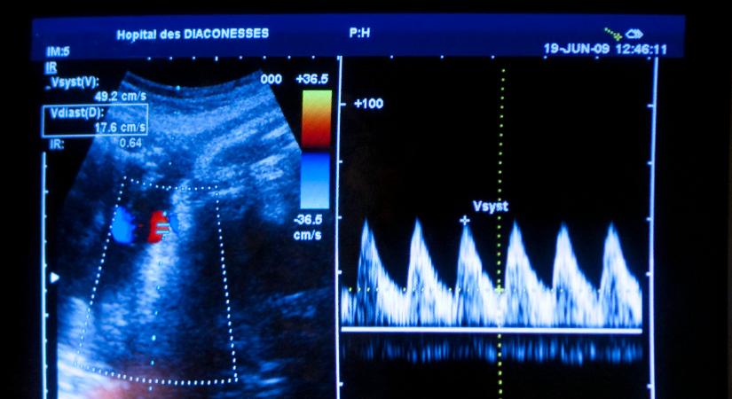 Tényleg a magzati szívhang meghallgatására kényszerítik a terhességmegszakítást kérő nőket?