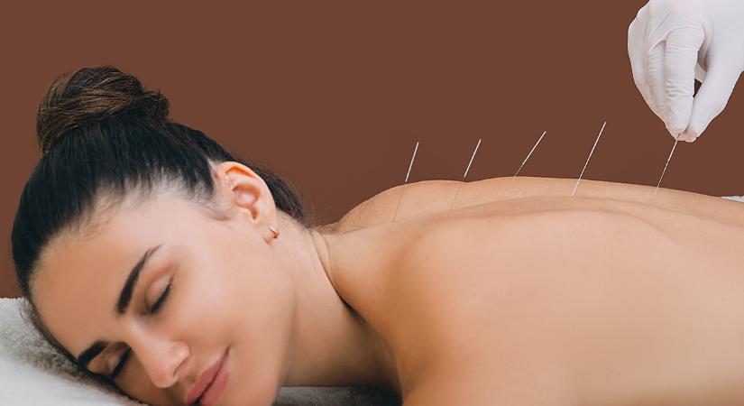 Öt testi-lelki probléma, amikor sokat segíthet az akupunktúra