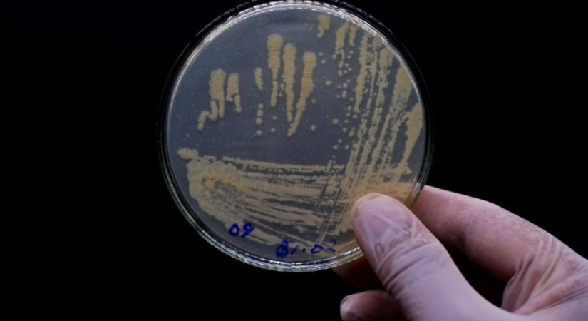 Tesztelték, mennyi mikroorganizmus található a Combino ülésén és kapaszkodóján