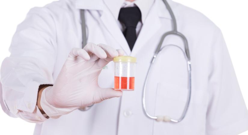 Sokan nem szedik az orvos által rendelt magas vérnyomás elleni gyógyszereket - Hírek - goprojekt.hu
