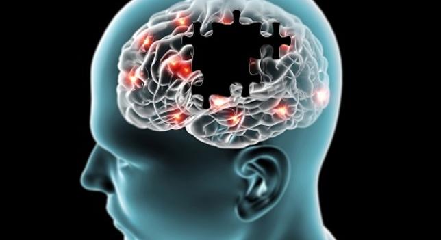 Óriási áttörés az Alzheimer-kór kezelésében: olyan gyógyszert találtak, ami lassítja a betegség előrehaladását