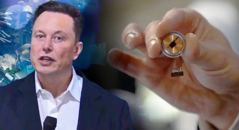 A saját fejébe is beülteti Elon Musk a chipjét, amit hamarosan embereken tesztelnek