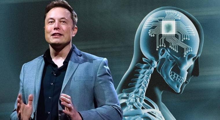 Elon Musk a saját agyába is beülteti a Neuraluink chipjét