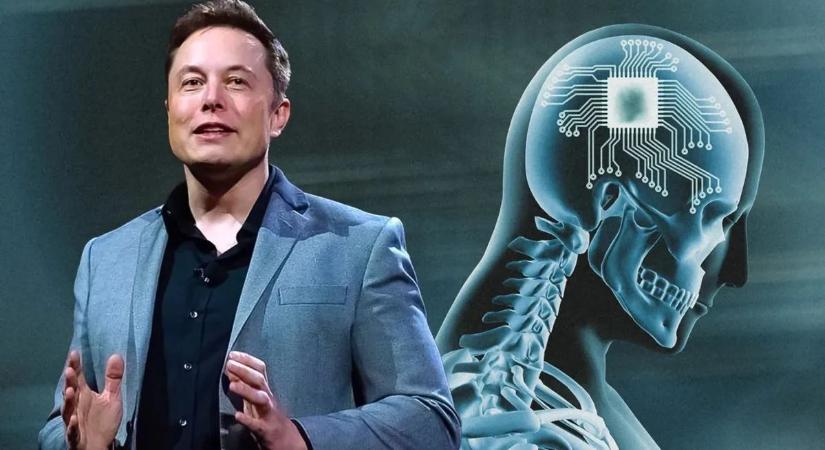 Elon Musk mikrochipje 6 hónapon belüli emberi agyba kerülhet