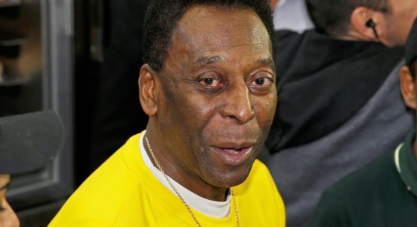 Pelé koronavírussal küzd, tüdőgyulladást kapott