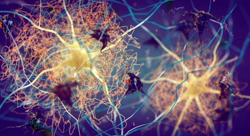 Vértesztet fejlesztettek az Alzheimer-kór kimutatására