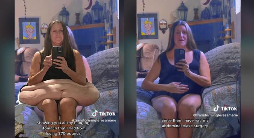 Elképesztő átalakulás: 160 kilót fogyott Teresa