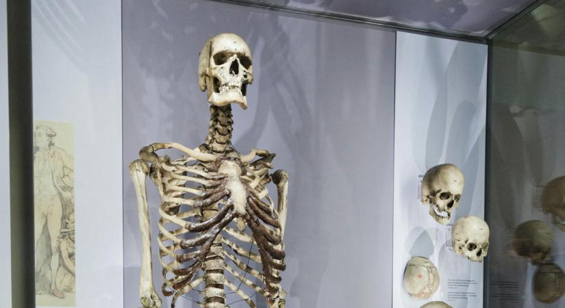 Eltávolítják az ír óriás csontjait a múzeumból, ahol akarata ellenére állították ki
